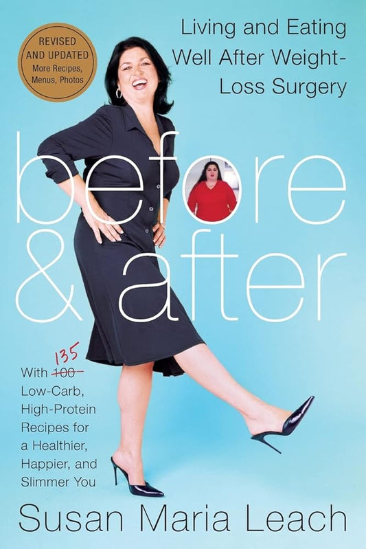 Before & After, Revised Edition: Living and Eating Well After Weight-Loss Surgery cover image